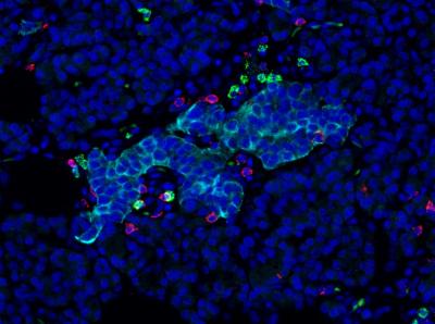 Diabetes Discovery