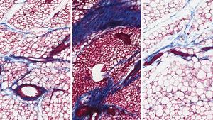 mouse mammary tissue collagen