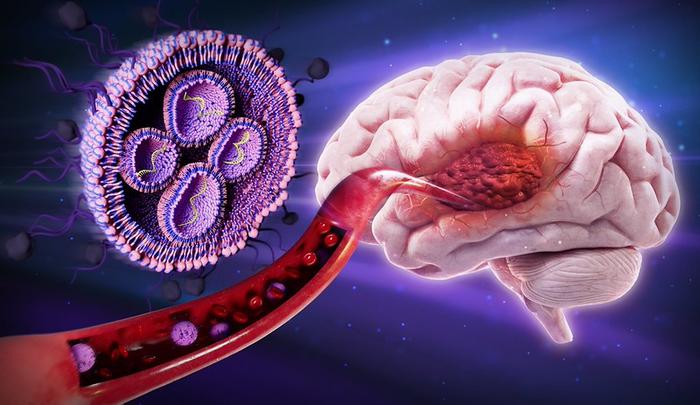 Glioblastoma nanomedicine graphic by Parinaz Ghanbari