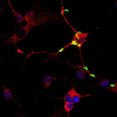 Toxoplasma Infection in Brain Tissue