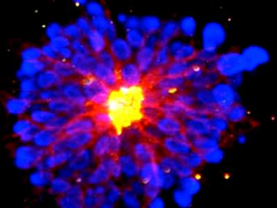 Neural Stem Cells