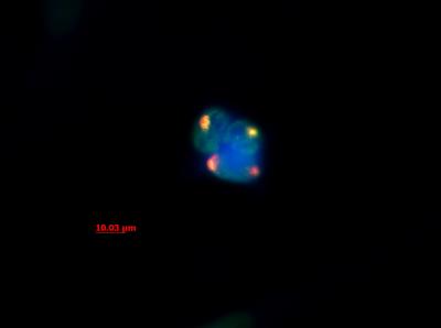 Caltech Researcher Sheds Light on M.O. of Unusual RNA Molecules