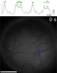 Widefield View of Spontaneous Activity in the Mature Visual Cortex