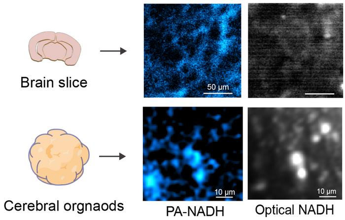 Figure 3. Photoacoustic and Optical Imaging of NADH in Brain Slices and Cerebral Organoids.