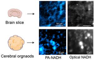 Figure 3. Photoacoustic and Optical Imaging of NADH in Brain Slices and Cerebral Organoids.