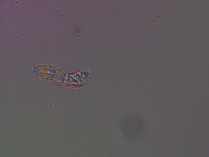 Bdelloid rotifer feeding