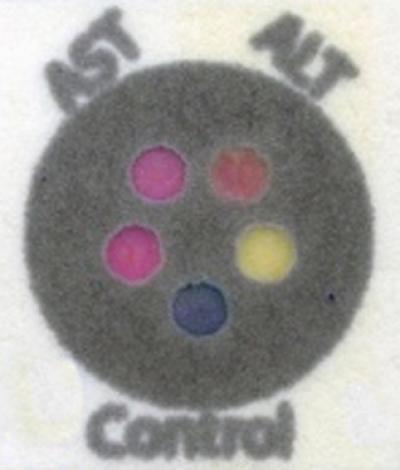 Paper-Based Blood Test Measures Liver Damage (2 of 2)