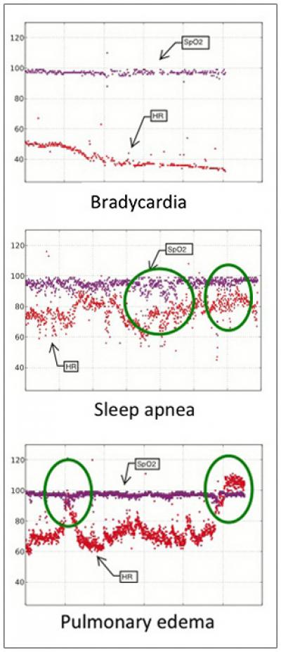 Cases Uncovered by Wireless Sensor Network