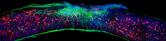 Spinal cord section