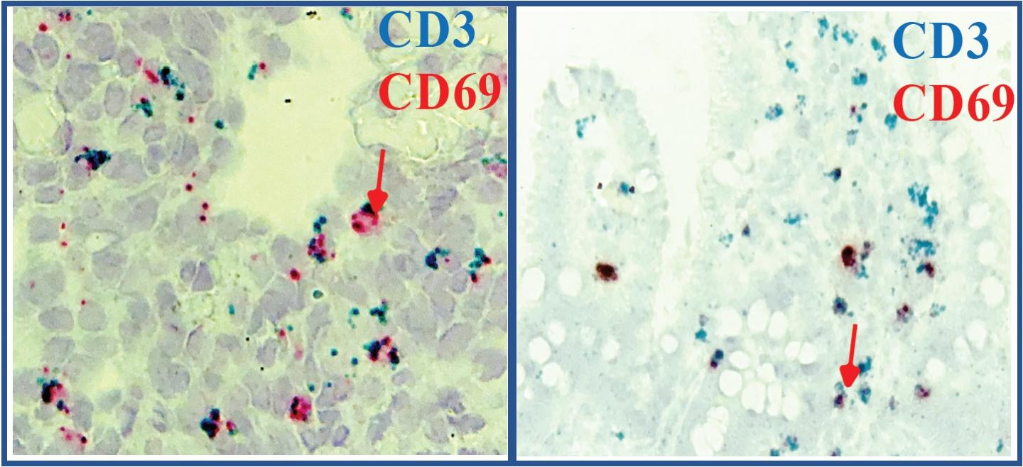 Fetal Gut Immunity