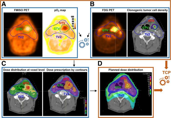 Biologically individualized radiotherapy based on synergistic use of 18F-FDG and 18F-FMISO PET