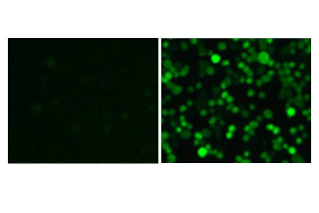 New Receptor Found on Scavenger Cells