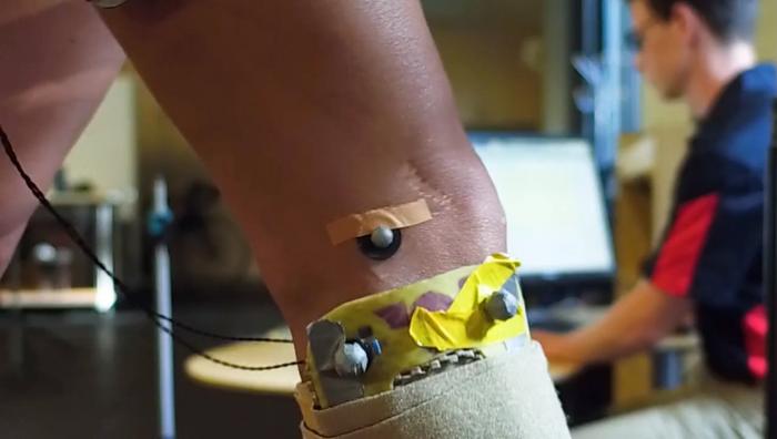 knee pain study