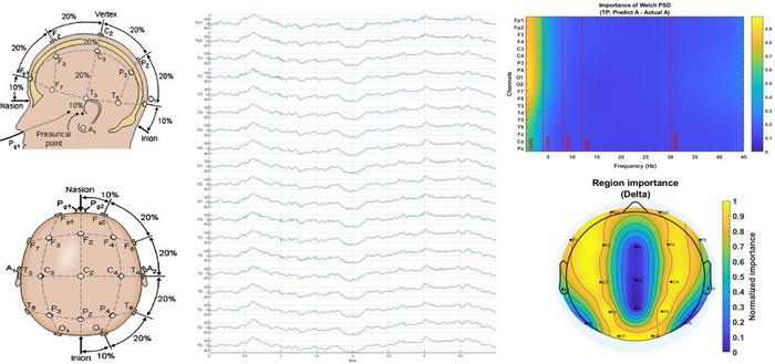 AI and EEG Brainwave Analysis