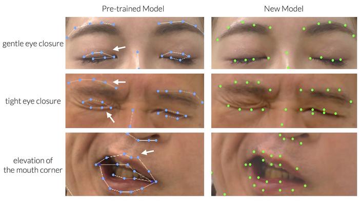 A “fined-tuned” AI approach – including manual annotation of facial keypoints – showed clear improvement in accuracy for automated evaluation of facial palsy.