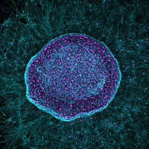 SereNeuro Therapeutics unveiled new data today on a novel approach to chronic pain management and joint tissue preservation.