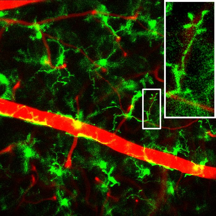 251007_tachibana_transpupil_microglia