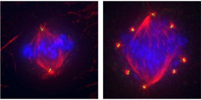 Centrioles in Healthy and Breast Cancer Cells