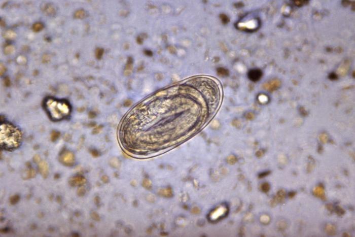 Fast Test Can Monitor Drug Resistance in Hookworms
