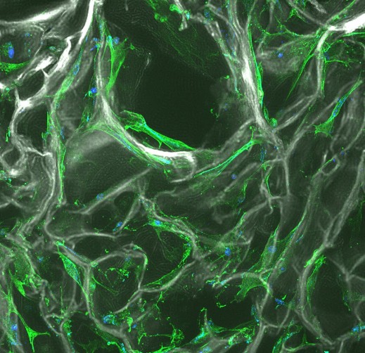 myogenic differentiation on scaffold