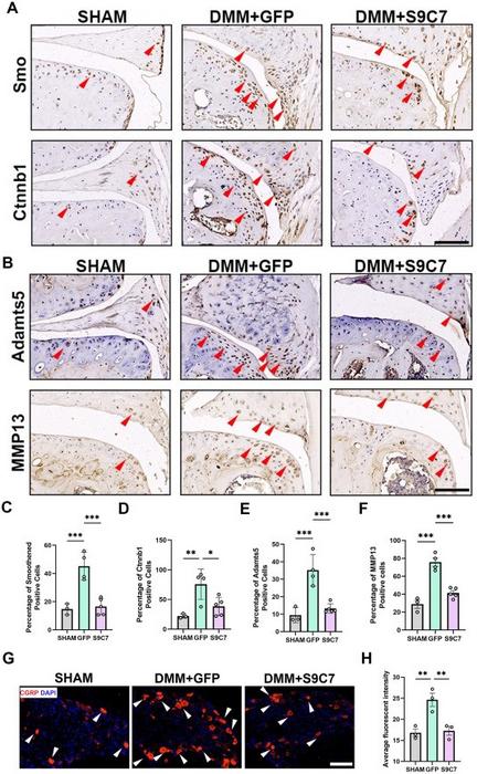 CasRx-mediated gene knockdown decreased OA-associated factors in tissues.