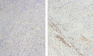 Microscopic images of mouse ovarian cancers.