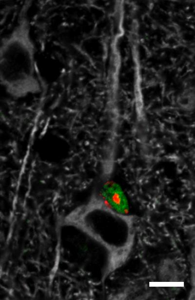 Optogenetics Links Neuronal Activity to Adaptive Changes in Myelin (4 of 6)