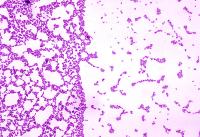 Streptococcus Mutans