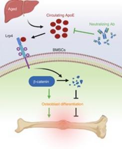 Neutralizing ApoE restores bone healing during aging