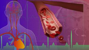 cerebral microvascular volumetric pulsatility