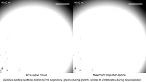 Bacterial segmentation