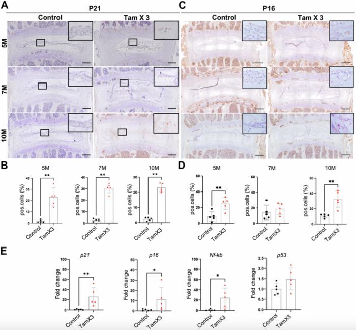 Runx1 overexpression induces early onset of intervertebral disc degeneration