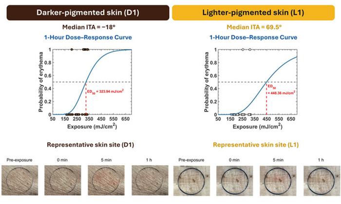 Laser exposure in dark- and light-skinned swine