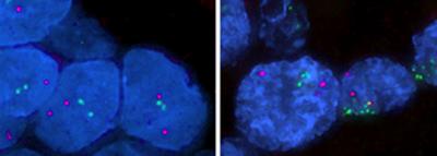 Gene Positions in Normal vs. Cancerous Tissue