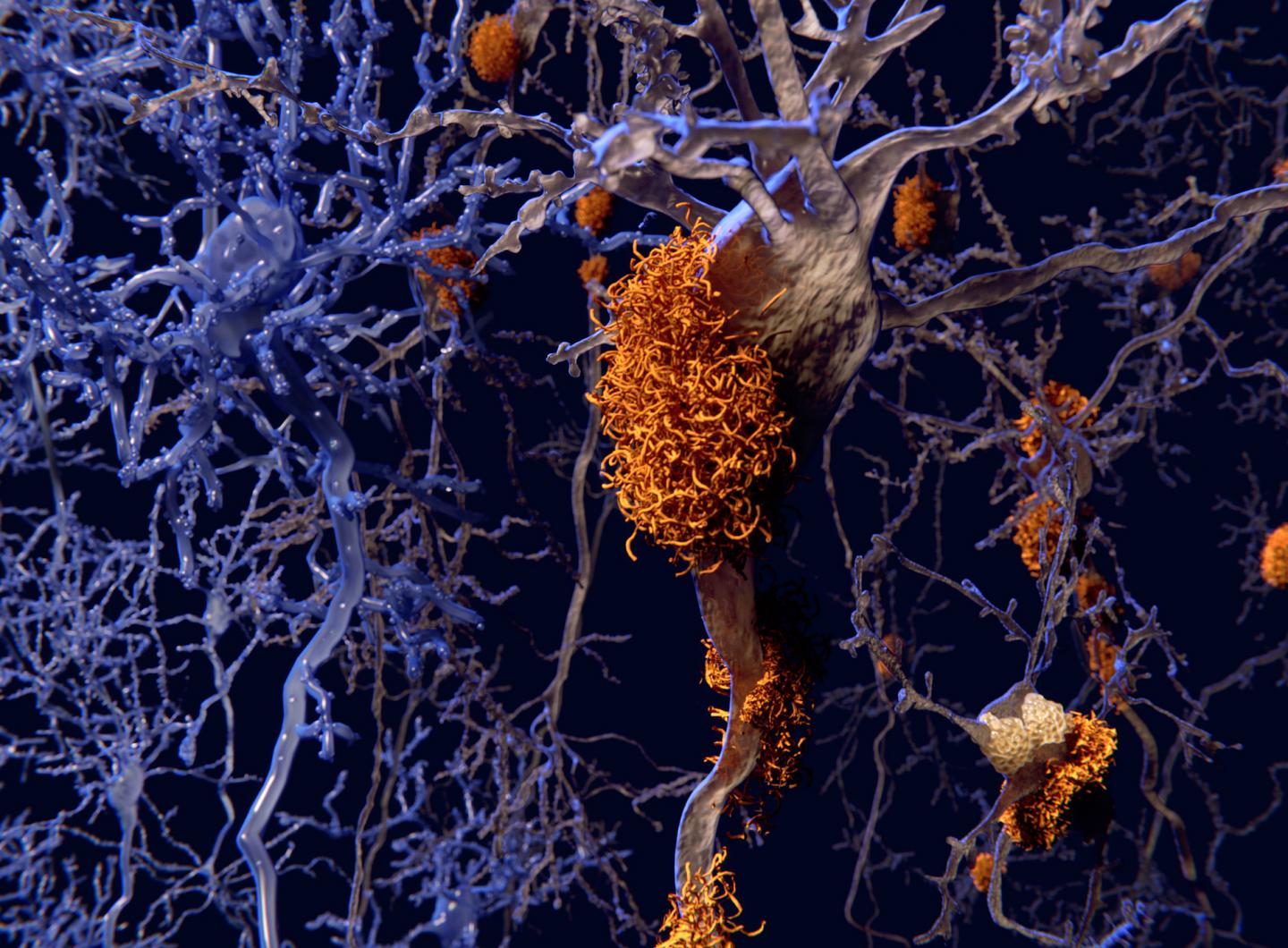 Tau Neuron