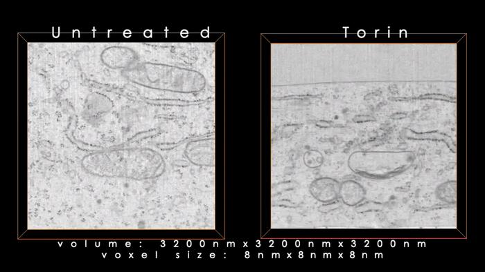 Enhanced FIB-SEM images of untreated and nutrient-starved cells (400 voxels)