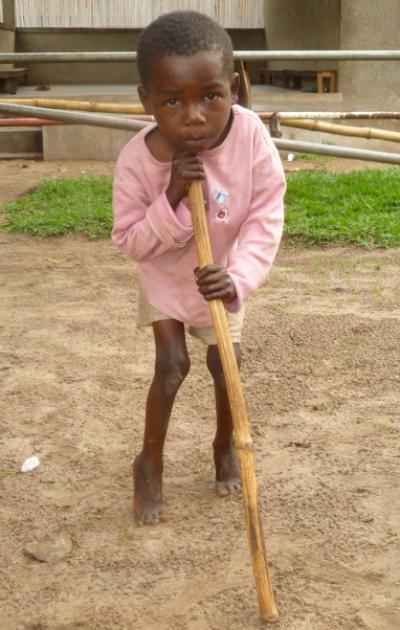 Child with Konzo