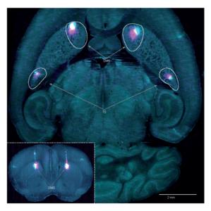 Dorsomedial striatum and tail of the striatum