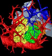 Technicolor Lung
