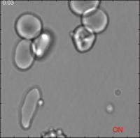 Membrane Deformations Induced by Tweezer-manipulation