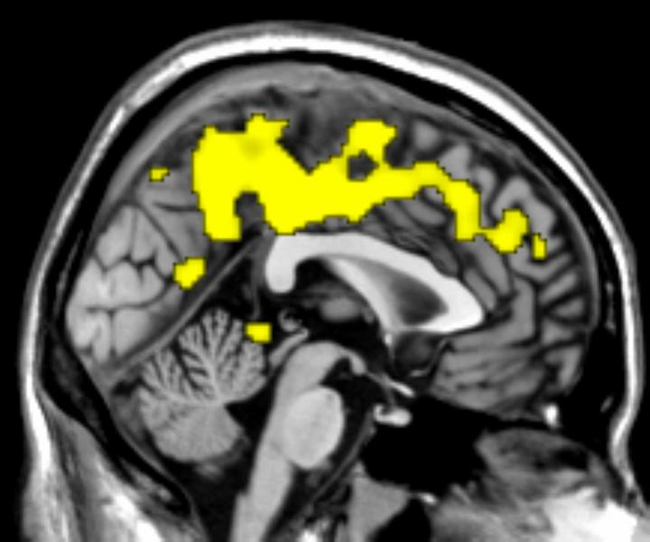 fApEn on Brain