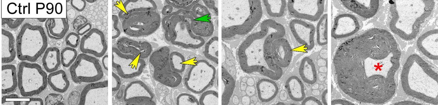 Sciatic nerves from 3-month-old mice in cross section:
