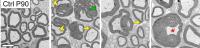 Sciatic nerves from 3-month-old mice in cross section: