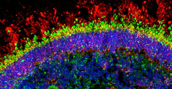 RPGRIP1 disease retinal organoid treated with AAV-RPGRIP1