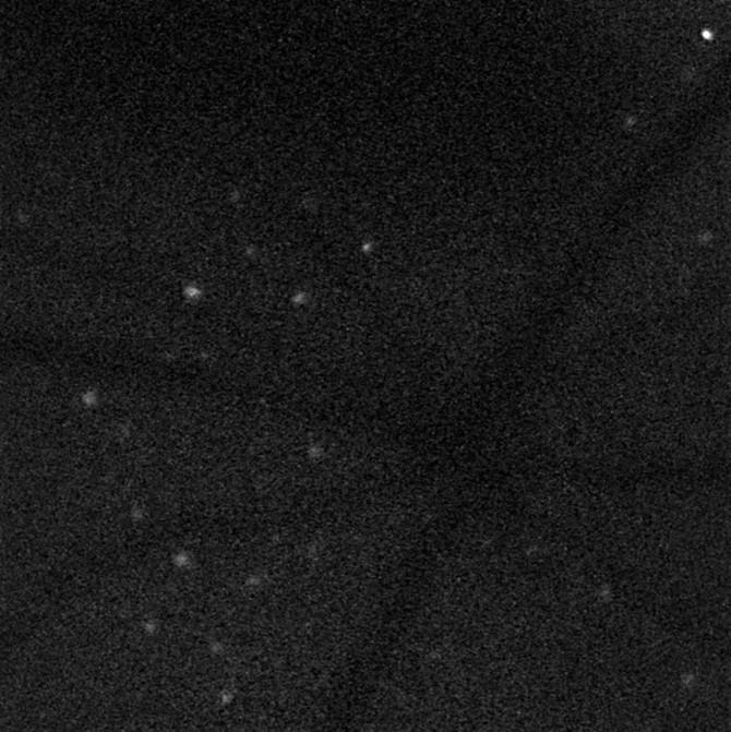 Starry, Starry Retina