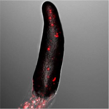 Slug of Social Amoebae