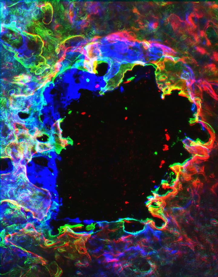 New Clarity in the Imaging of Bone Tumors (2 of 2)