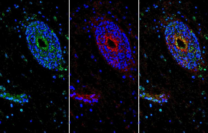 Enhancing the Blood-Brain Barrier