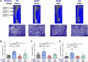 D, L-Buthionine-(S, R)-sulfoximine recapitulates the anti-obesity effects of sulfur amino acid restriction without the associated deleterious effects on bone in male mice