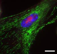 Senescent Fibroblast Cells
